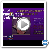 04  Posterior Lumbar Interbody Fusion (PLIF)